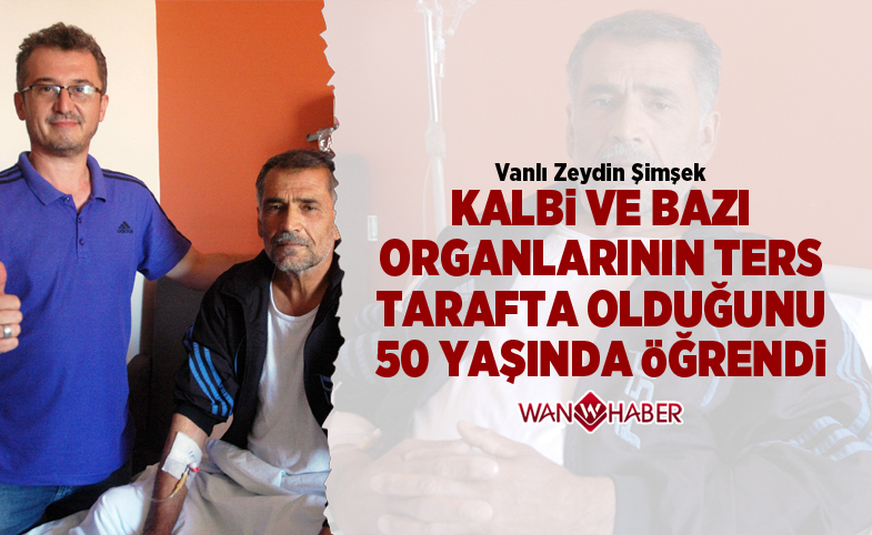 Kalbi ve bazı organlarının ters tarafta olduğunu 50 yaşında öğrendi 